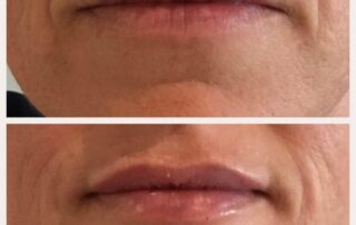 natural fuller looking lips