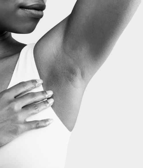 Hyperhidrosis (Excessive Sweating)