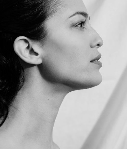 Jawline Filler