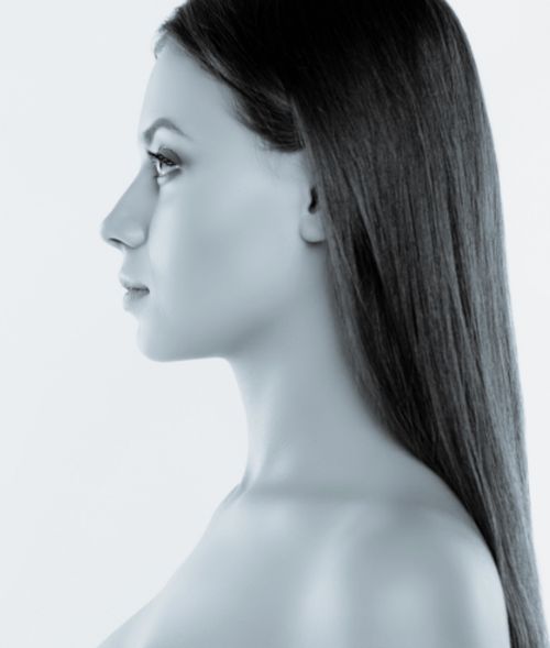 Non-Surgical Rhinoplasty