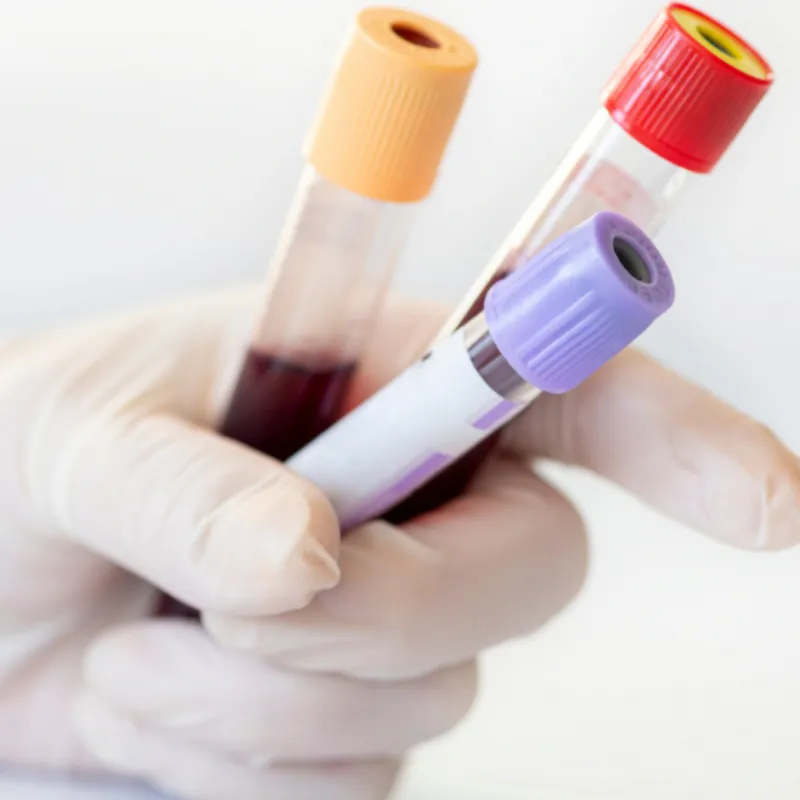Blood Test
